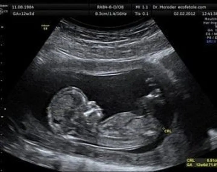 Czy termin porodu z USG to wiarygodny wskaźnik? Sprawdzamy!