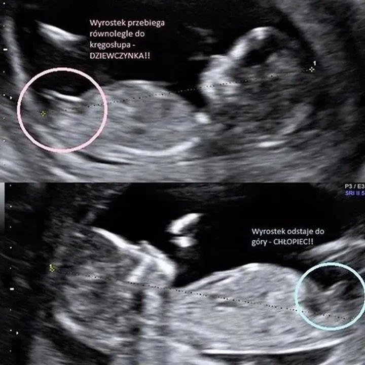 Kiedy i w którym tygodniu widać płeć dziecka? Zobacz, jak to działa!