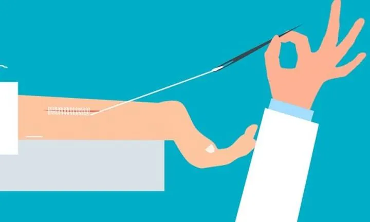 Gojenie ran poporodowych