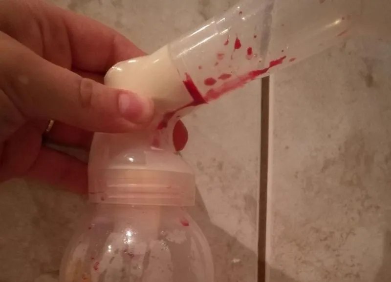 Krwawiące sutki przy karmieniu piersią