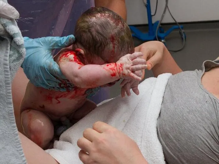 Metody przyspieszania porodu