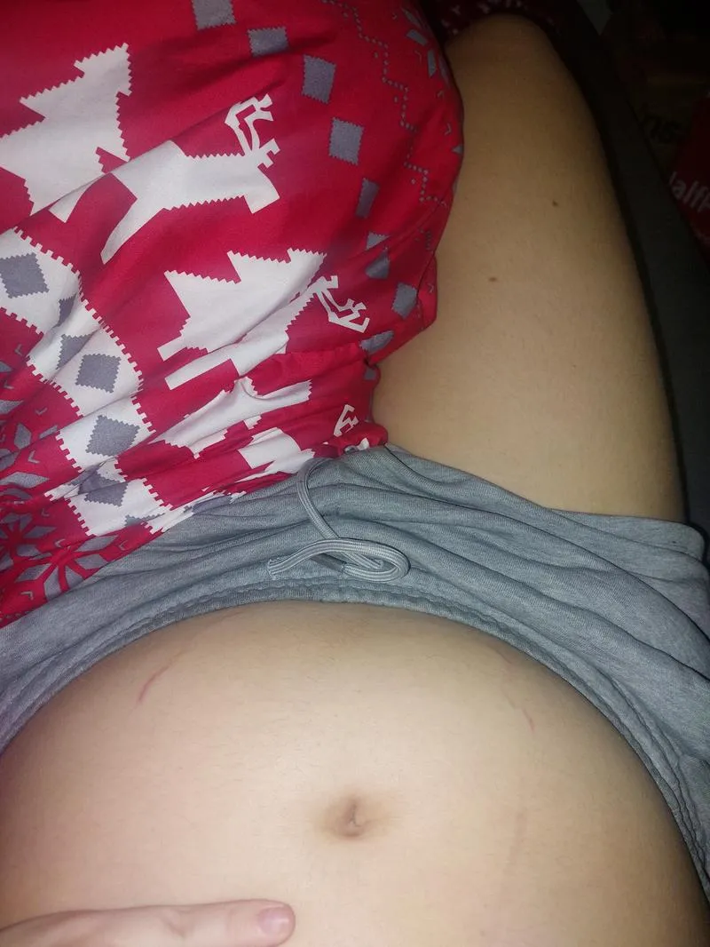 Naturalne sposoby na rozstępy