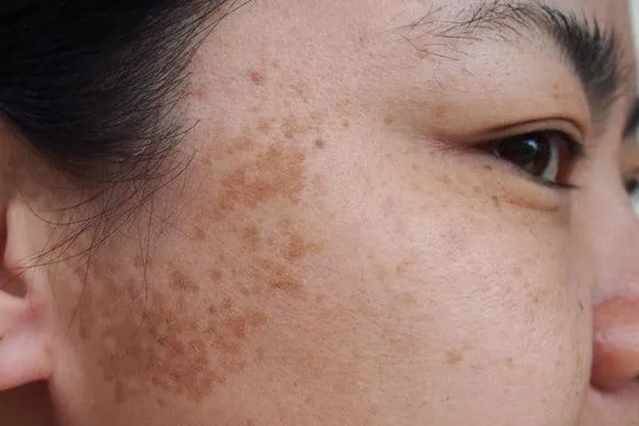 Ochrona przeciwsłoneczna