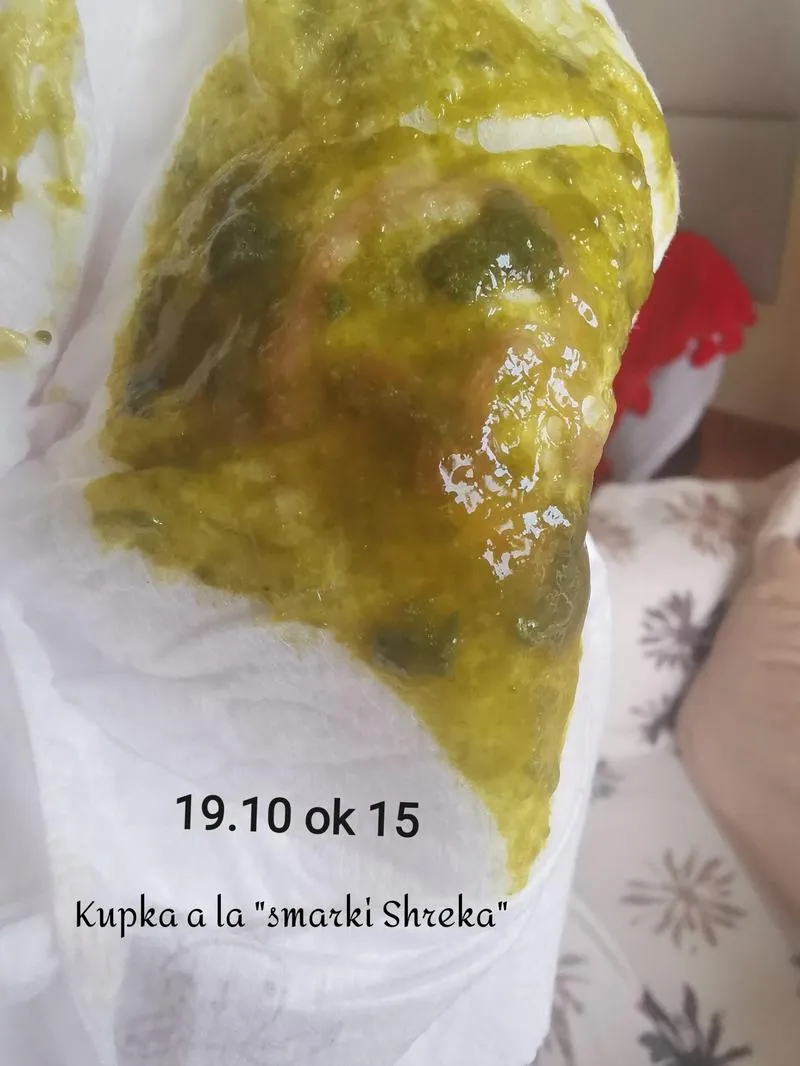 Zielone kupki u niemowląt